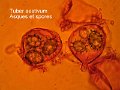 Tuber aestivum-amf1901-micro